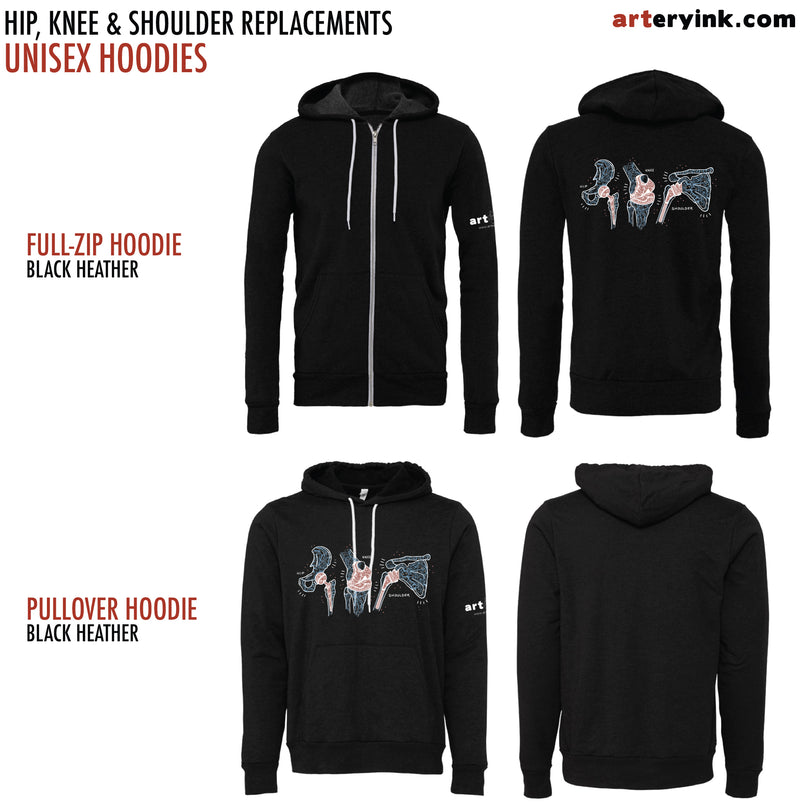 Hip, Knee & Shoulder Replacements Pre-Order